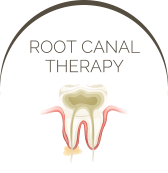 Root Canal Therapy