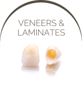 Veneers & Laminates